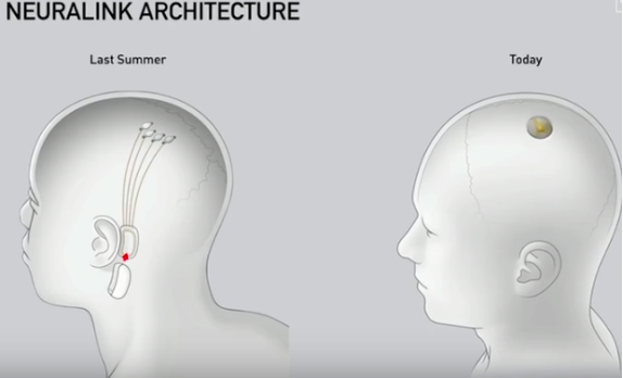 马斯克脑机接口、BrainOS 相继发布，未来已来？