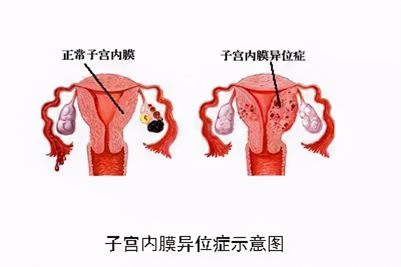 月经期间可以减肥吗_月经期间减肥的方法和注意事项