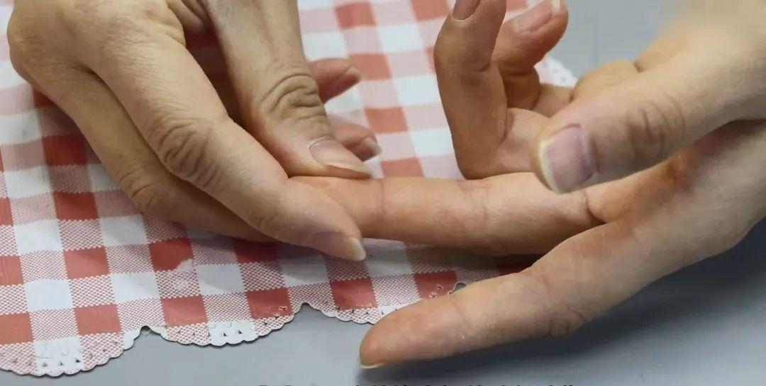 手指头扎刺怎么剔除_手指头扎刺的剔除方法