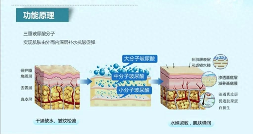 精华浓度高好吗，精子浓度高好还是低好