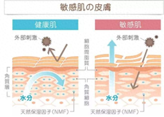 敏感肌是什么原因导致的，敏感肌的形成