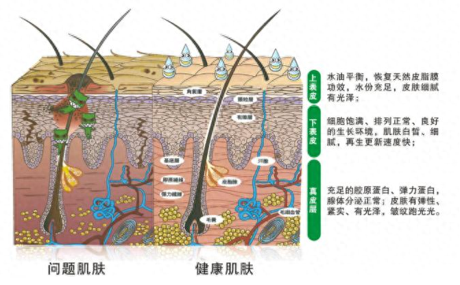 什么是假性油皮，假性油皮怎么办