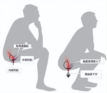 坐便器和蹲便器哪个好，蹲便和坐便哪个更健康