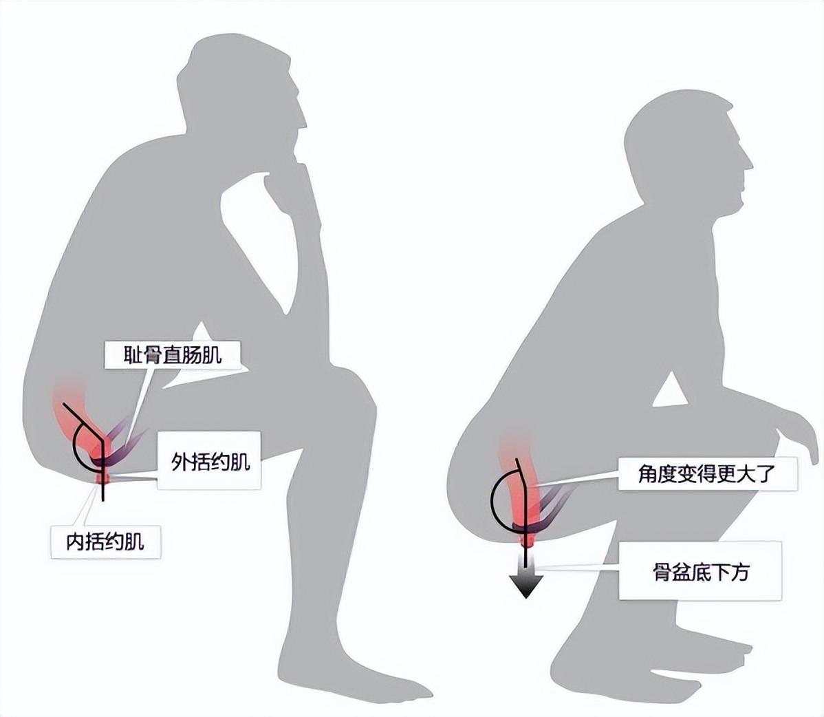 坐便器和蹲便器哪个好，蹲便和坐便哪个更健康